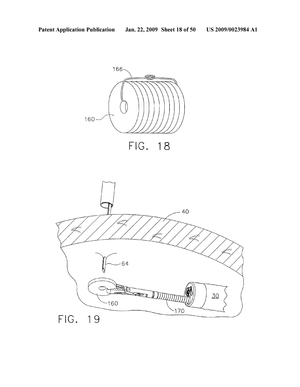 DEVICE FOR INSUFFLATING THE INTERIOR OF A GASTRIC CAVITY OF A PATIENT - diagram, schematic, and image 19