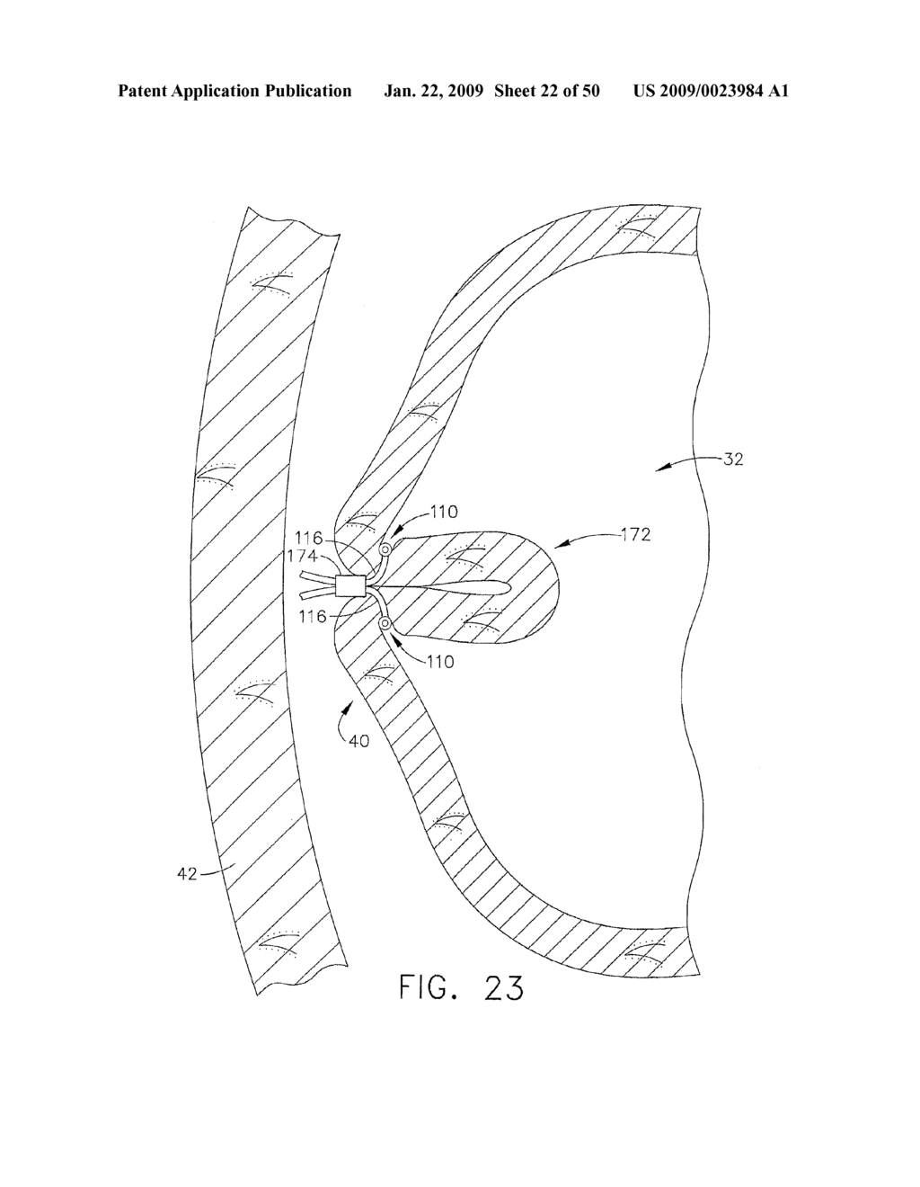 DEVICE FOR INSUFFLATING THE INTERIOR OF A GASTRIC CAVITY OF A PATIENT - diagram, schematic, and image 23