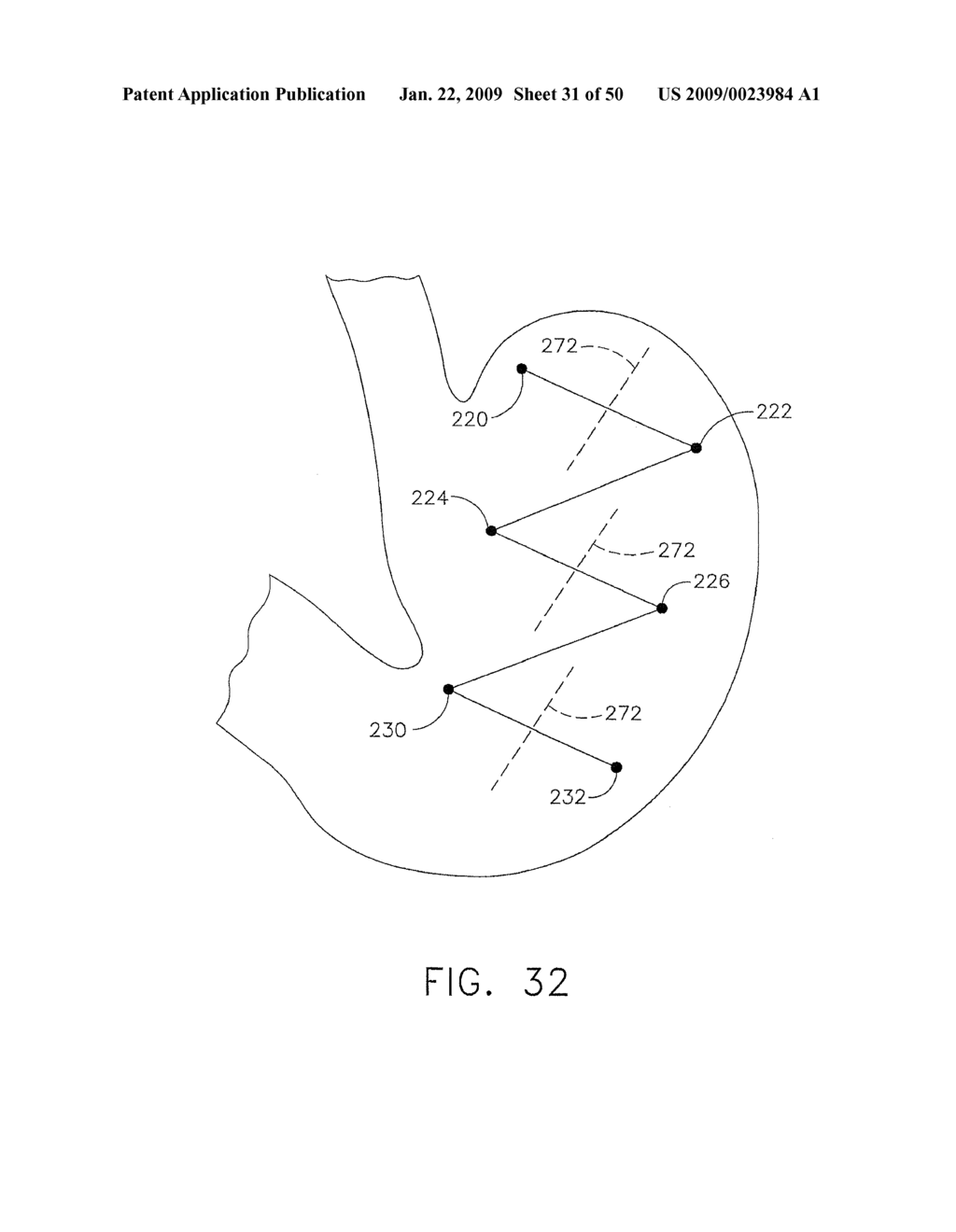 DEVICE FOR INSUFFLATING THE INTERIOR OF A GASTRIC CAVITY OF A PATIENT - diagram, schematic, and image 32