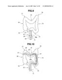 Endoscope Insertion Portion and Endoscope diagram and image