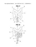 Endoscope Insertion Portion and Endoscope diagram and image