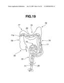 Endoscope Insertion Portion and Endoscope diagram and image