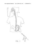  DEVICE FOR INSUFFLATING THE INTERIOR OF A GASTRIC CAVITY OF A PATIENT diagram and image
