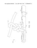  DEVICE FOR INSUFFLATING THE INTERIOR OF A GASTRIC CAVITY OF A PATIENT diagram and image