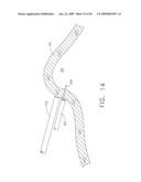  DEVICE FOR INSUFFLATING THE INTERIOR OF A GASTRIC CAVITY OF A PATIENT diagram and image