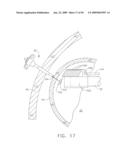  DEVICE FOR INSUFFLATING THE INTERIOR OF A GASTRIC CAVITY OF A PATIENT diagram and image