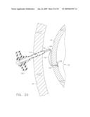  DEVICE FOR INSUFFLATING THE INTERIOR OF A GASTRIC CAVITY OF A PATIENT diagram and image