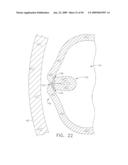  DEVICE FOR INSUFFLATING THE INTERIOR OF A GASTRIC CAVITY OF A PATIENT diagram and image