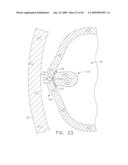  DEVICE FOR INSUFFLATING THE INTERIOR OF A GASTRIC CAVITY OF A PATIENT diagram and image