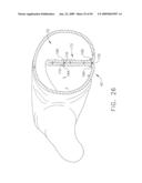  DEVICE FOR INSUFFLATING THE INTERIOR OF A GASTRIC CAVITY OF A PATIENT diagram and image