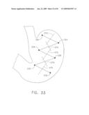  DEVICE FOR INSUFFLATING THE INTERIOR OF A GASTRIC CAVITY OF A PATIENT diagram and image