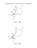  DEVICE FOR INSUFFLATING THE INTERIOR OF A GASTRIC CAVITY OF A PATIENT diagram and image