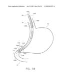  DEVICE FOR INSUFFLATING THE INTERIOR OF A GASTRIC CAVITY OF A PATIENT diagram and image