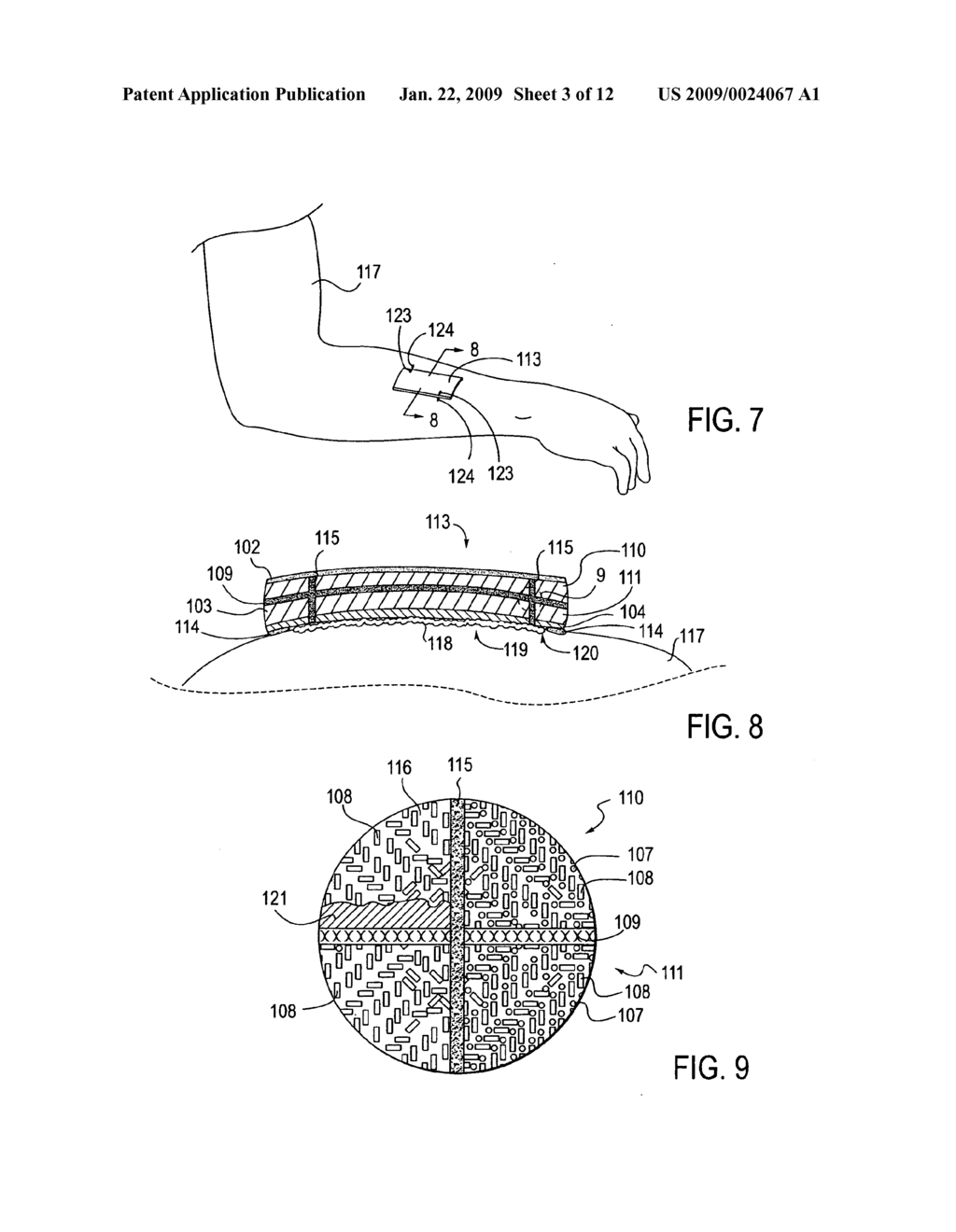 WOUND DRESSING AND APPARATUS FOR FORMING SAME - diagram, schematic, and image 04