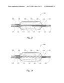 BALLOON FOLDING CONTROL MECHANISM diagram and image