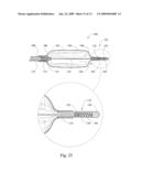 BALLOON FOLDING CONTROL MECHANISM diagram and image