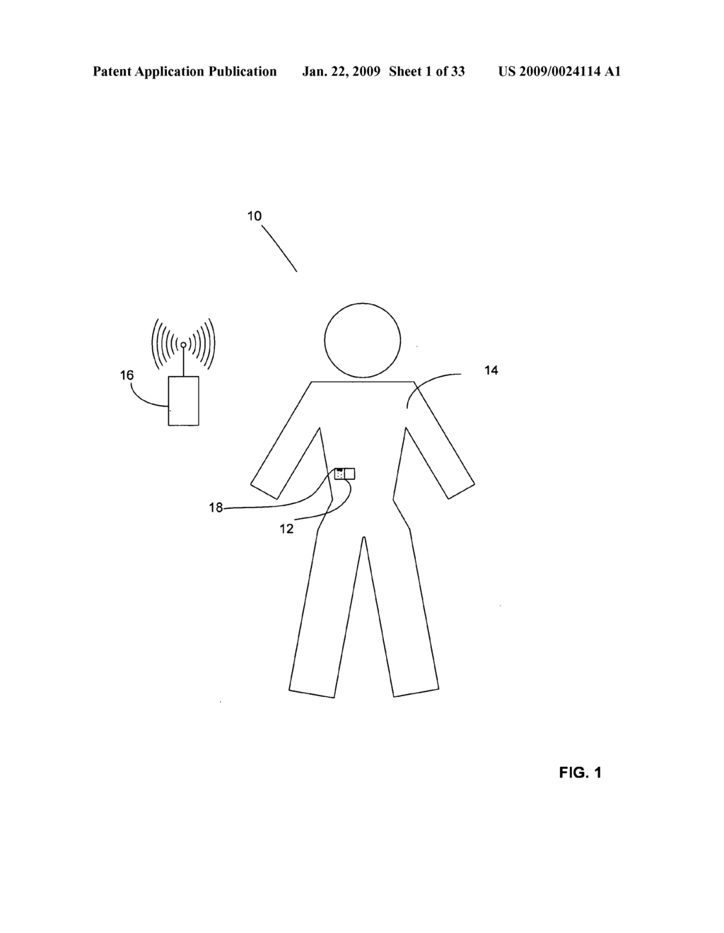 Method and system for control of osmotic pump device - diagram, schematic, and image 02