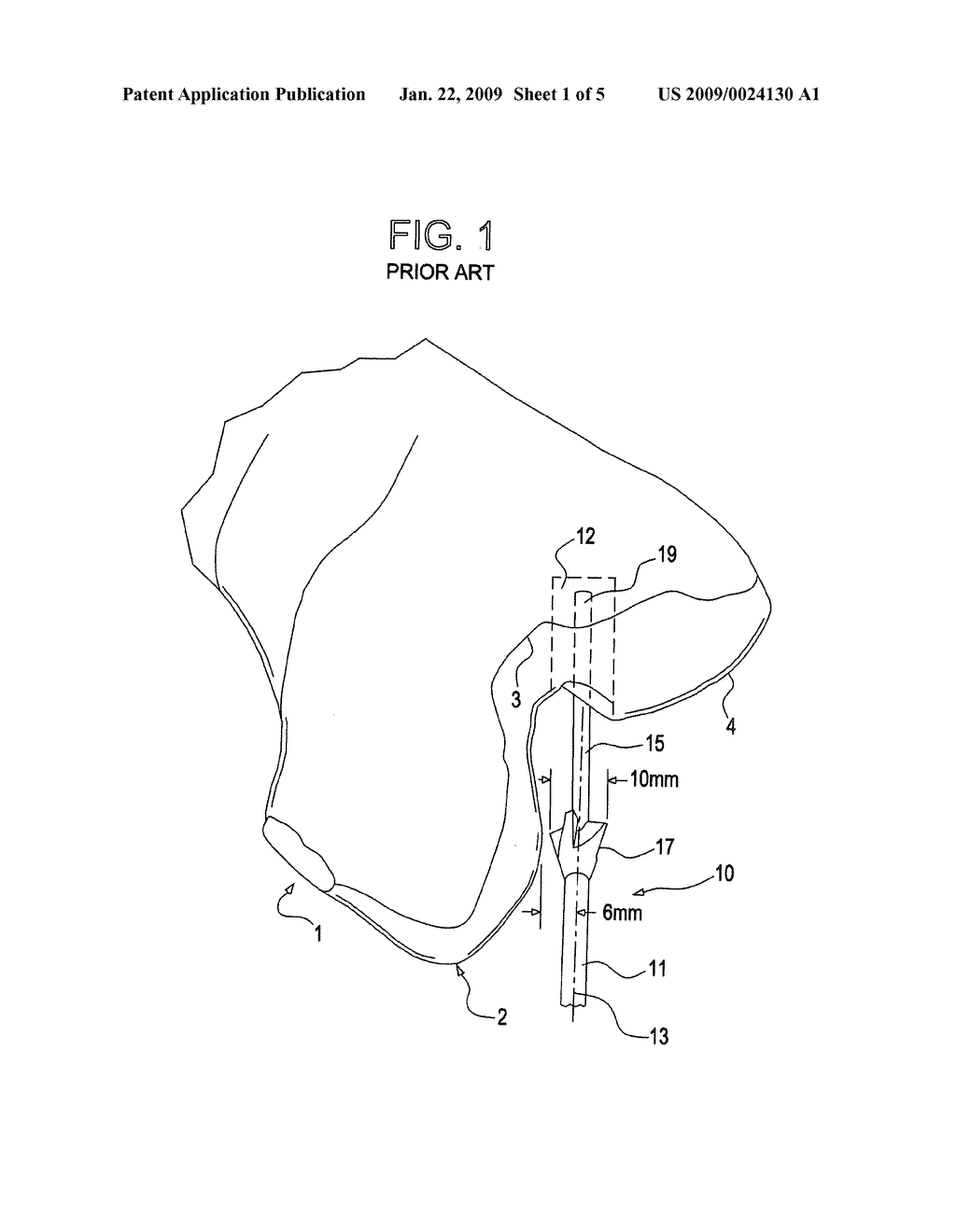 Cannulated drill bit with radially offset cutting edge - diagram, schematic, and image 02