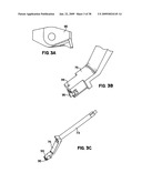 Apparatus and method for sternotomy closure diagram and image