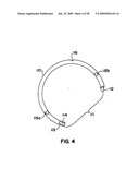 Apparatus and method for sternotomy closure diagram and image