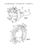 Apparatus and method for sternotomy closure diagram and image