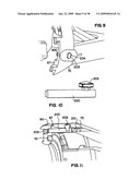 Apparatus and method for sternotomy closure diagram and image