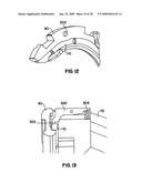 Apparatus and method for sternotomy closure diagram and image