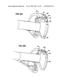 Apparatus and method for sternotomy closure diagram and image