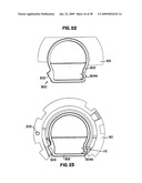 Apparatus and method for sternotomy closure diagram and image