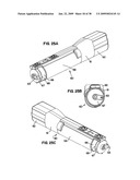 Apparatus and method for sternotomy closure diagram and image