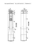 Apparatus and method for sternotomy closure diagram and image