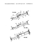 Apparatus and method for sternotomy closure diagram and image