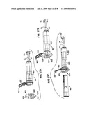 Apparatus and method for sternotomy closure diagram and image