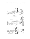 Apparatus and method for sternotomy closure diagram and image