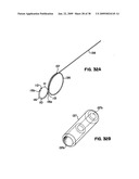 Apparatus and method for sternotomy closure diagram and image