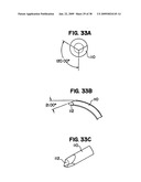 Apparatus and method for sternotomy closure diagram and image