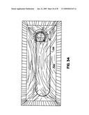 Apparatus and method for sternotomy closure diagram and image