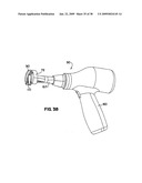 Apparatus and method for sternotomy closure diagram and image