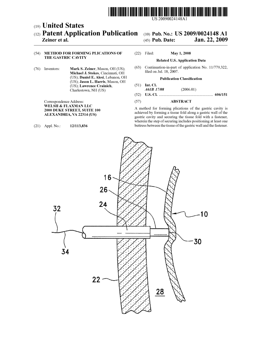 METHOD FOR FORMING PLICATIONS OF THE GASTRIC CAVITY - diagram, schematic, and image 01