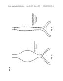 Custom-fitted blood vessel sleeve diagram and image