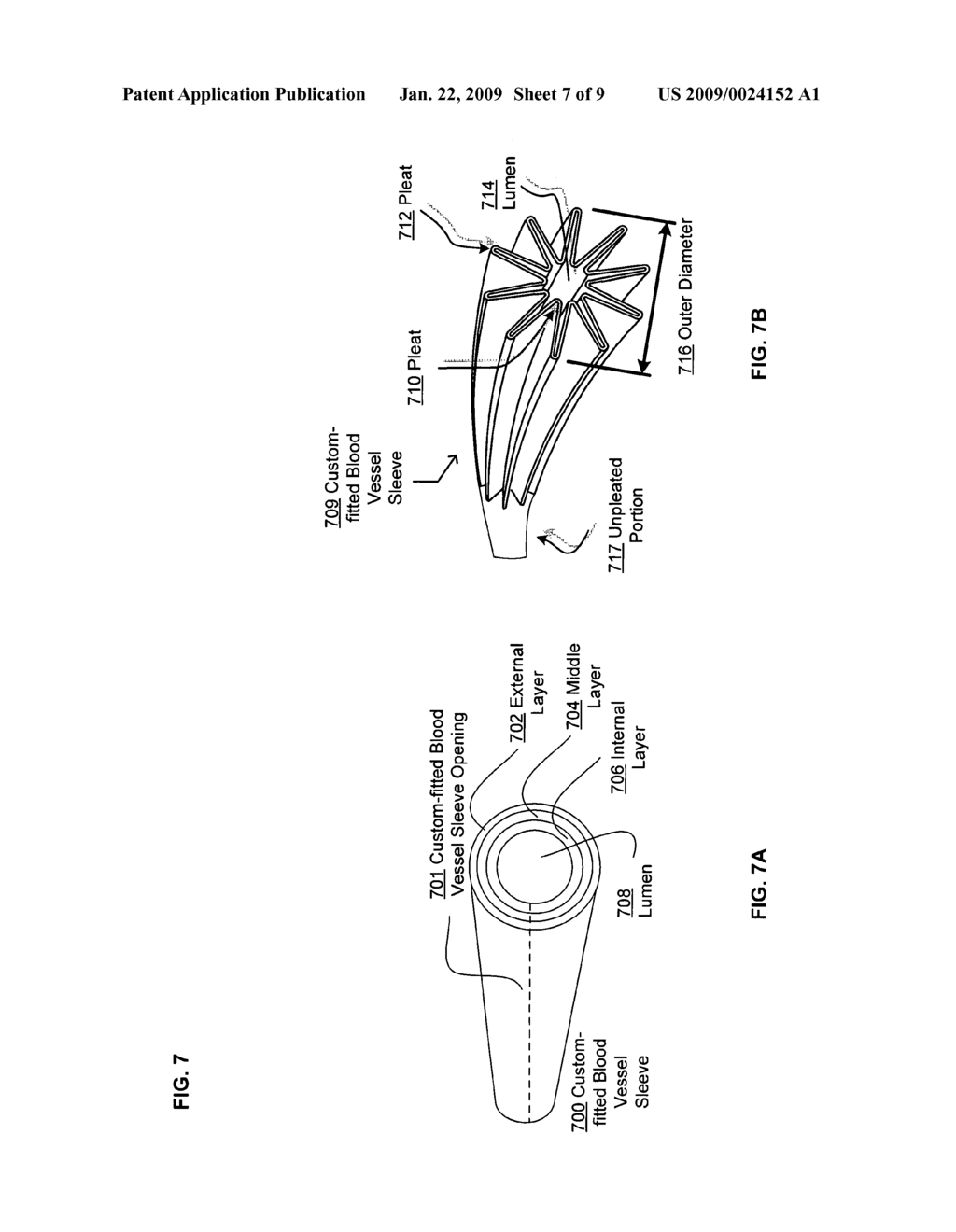 Custom-fitted blood vessel sleeve - diagram, schematic, and image 08