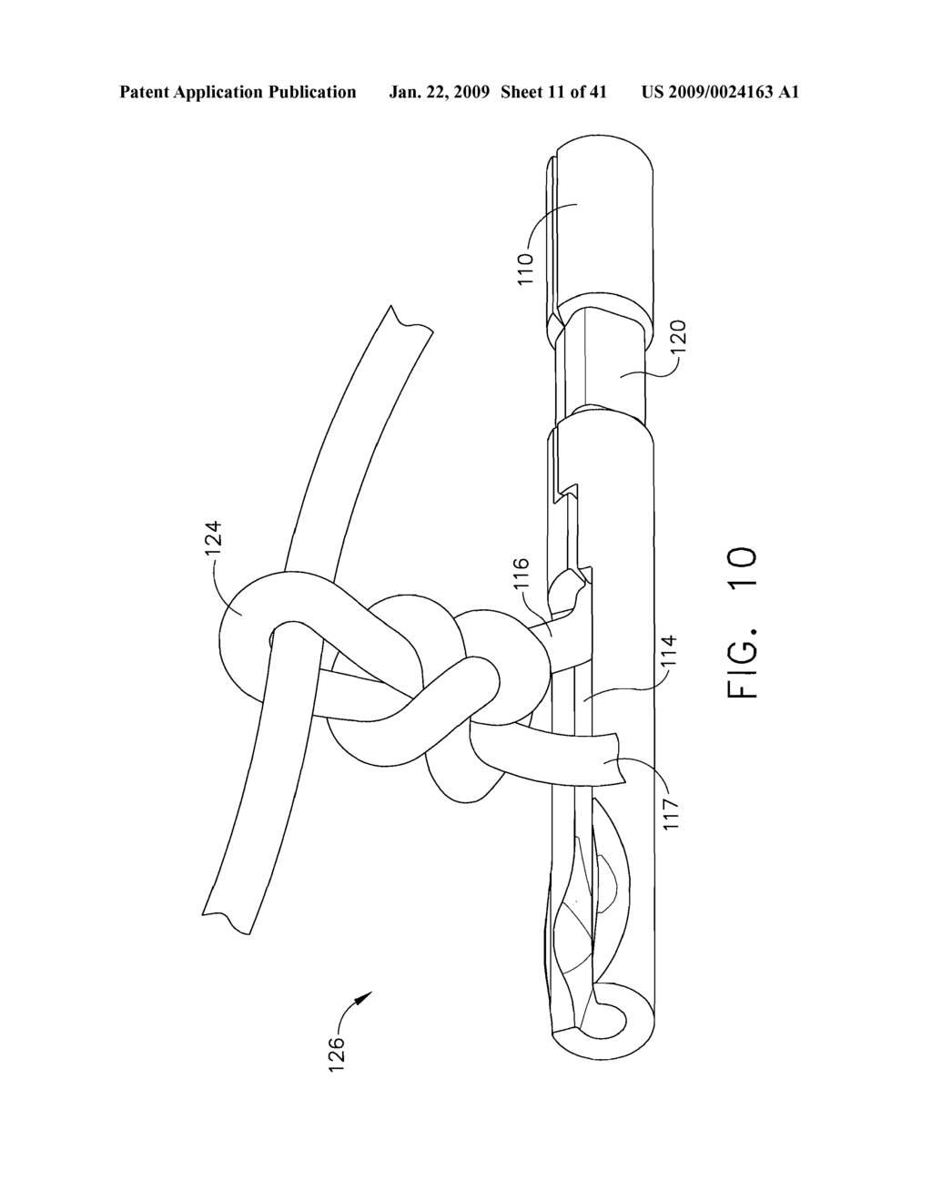 HYBRID ENDOSCOPIC/LAPAROSCOPIC METHOD FOR FORMING SEROSA TO SEROSA PLICATIONS IN A GASTRIC CAVITY - diagram, schematic, and image 12