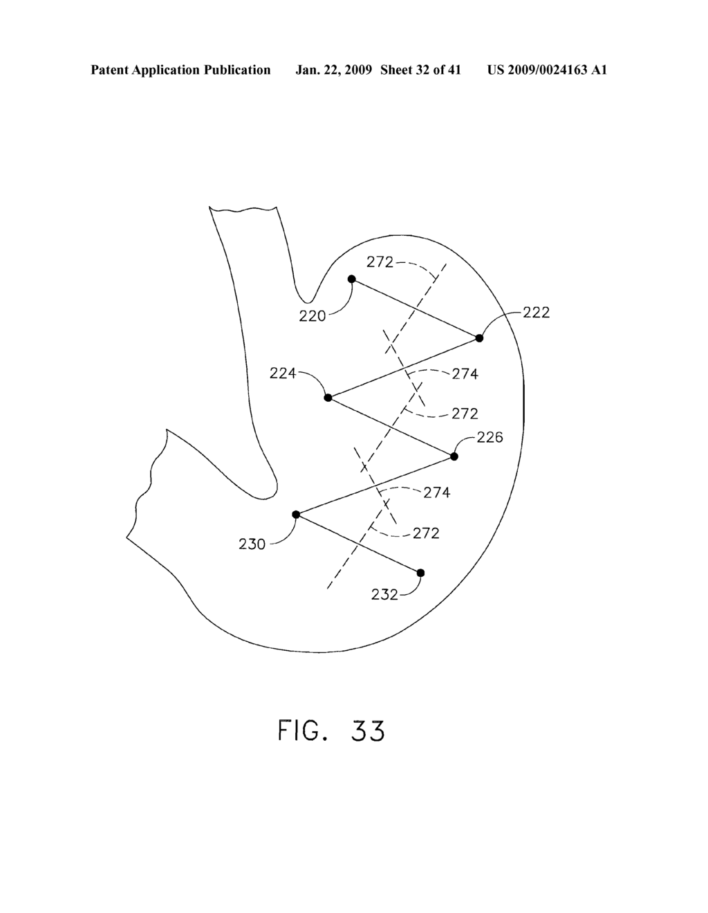 HYBRID ENDOSCOPIC/LAPAROSCOPIC METHOD FOR FORMING SEROSA TO SEROSA PLICATIONS IN A GASTRIC CAVITY - diagram, schematic, and image 33