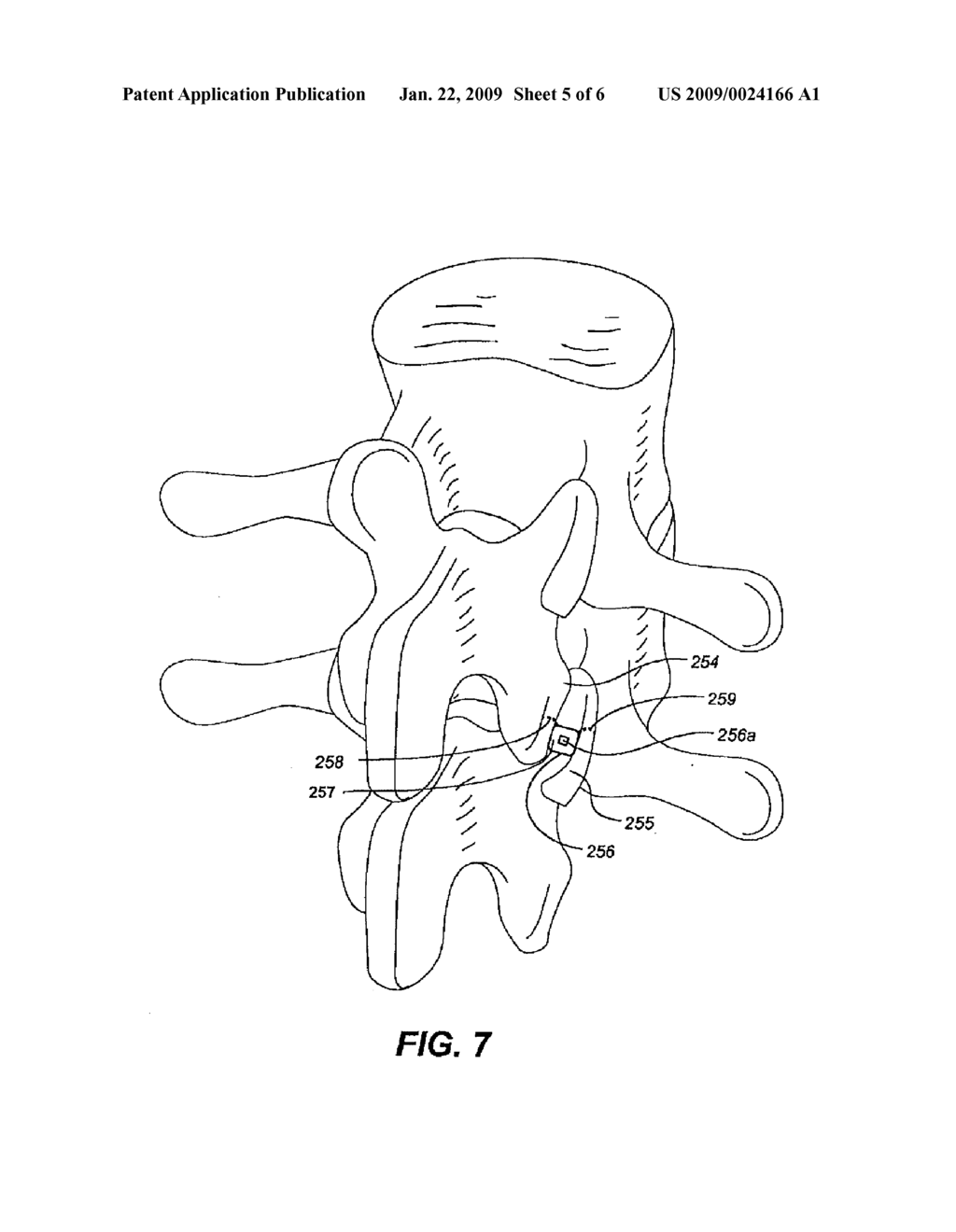 FACET DEVICE AND METHOD - diagram, schematic, and image 06