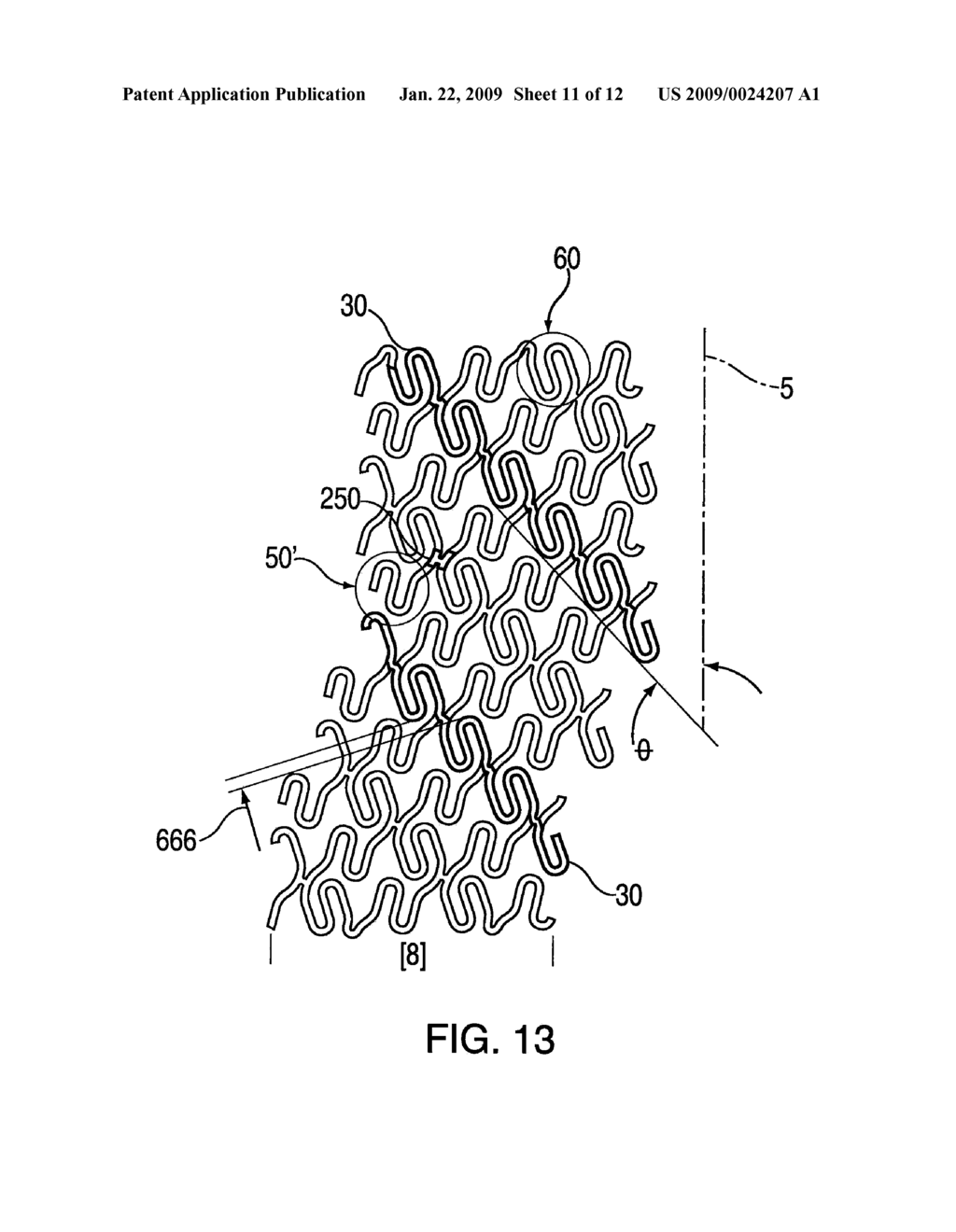 Stent Having Helical Elements - diagram, schematic, and image 12