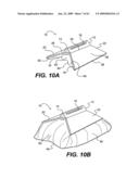 SPINAL DISC ANNULUS RECONSTRUCTION METHOD AND SPINAL DISC ANNULUS STENT diagram and image