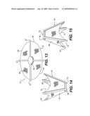 SPINAL DISC ANNULUS RECONSTRUCTION METHOD AND SPINAL DISC ANNULUS STENT diagram and image