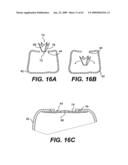 SPINAL DISC ANNULUS RECONSTRUCTION METHOD AND SPINAL DISC ANNULUS STENT diagram and image