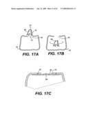 SPINAL DISC ANNULUS RECONSTRUCTION METHOD AND SPINAL DISC ANNULUS STENT diagram and image