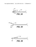 SPINAL DISC ANNULUS RECONSTRUCTION METHOD AND SPINAL DISC ANNULUS STENT diagram and image